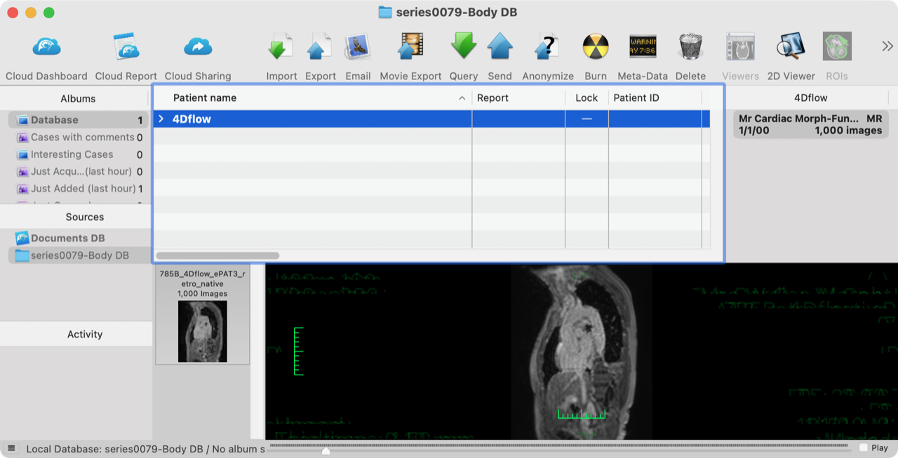 Added by email2trac Added by email2trac