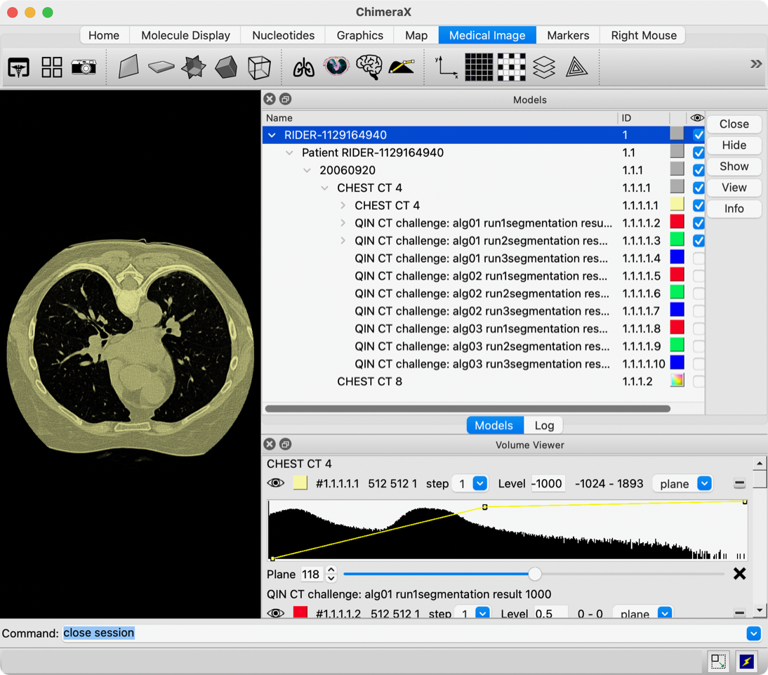 Added by email2trac Added by email2trac